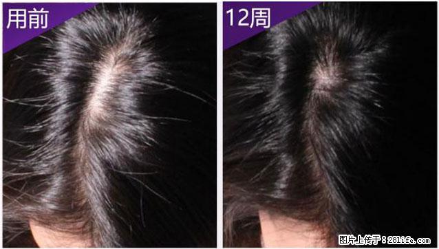 防脱踩坑无数?内见蓝铜肽,才是脱发星人的救命成分! - 上海生活资讯 - 上海28生活网 sh.28life.net